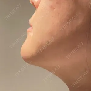 東京美容外科 梅田院の