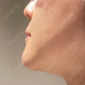 東京美容外科 梅田院の