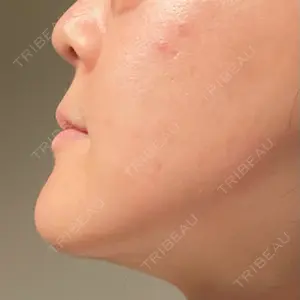 東京美容外科 梅田院の