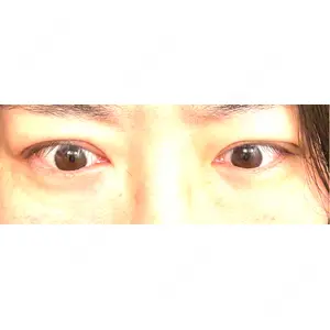 東京ココセランクリニック口コミ