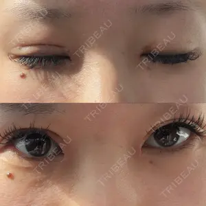 サラ美容外科口コミ