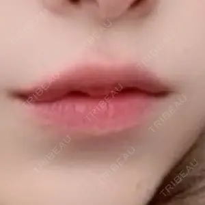 アリエル美容クリニック アリエル美容クリニック 水戸院口コミ