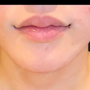 LOUIS CLINIC 二子玉川院【ルイクリニック】口コミ