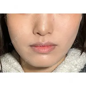 東京シンデレラ美容外科 東京シンデレラ美容外科 池袋院口コミ