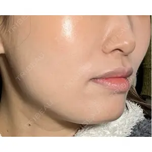 東京シンデレラ美容外科 東京シンデレラ美容外科 池袋院口コミ