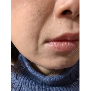 ゆきスキンクリニック 東池袋口コミ