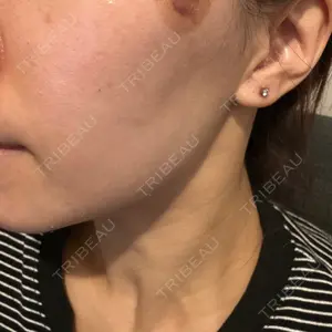 メディアージュクリニック メディアージュクリニック 青山院口コミ