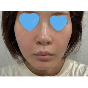 口コミ