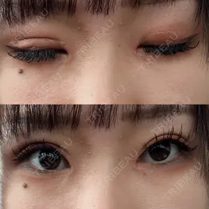 サラ美容外科口コミ