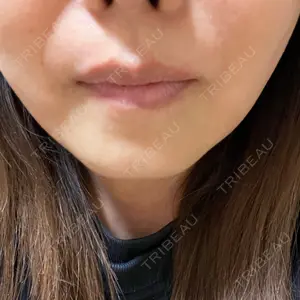 Natural Skin Clinic Natural Skin Clinic 笹塚院口コミ