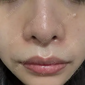 銀座TMクリニック口コミ