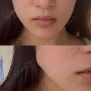 DMTC CLINIC DMTC美容皮膚科 大宮院口コミ