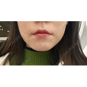 フィラークリニック フィラークリニック 名古屋栄院口コミ