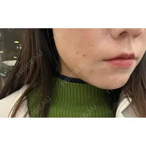 フィラークリニック フィラークリニック 名古屋栄院口コミ