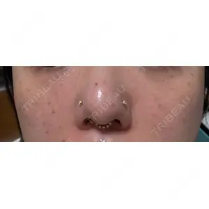 Natural Skin Clinic Natural Skin Clinic 自由ヶ丘院口コミ