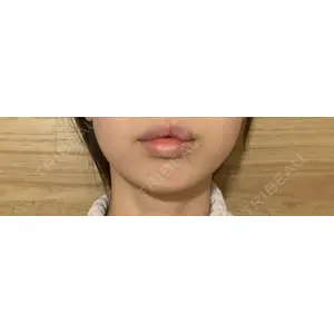 アリエル美容クリニック アリエル美容クリニック 水戸院口コミ