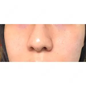 ゆきスキンクリニック 東池袋口コミ