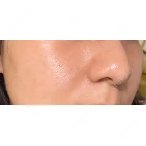 ゆきスキンクリニック 東池袋口コミ