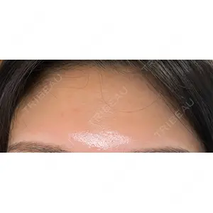 ゆきスキンクリニック 東池袋口コミ