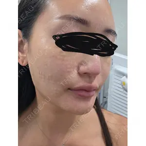 スマートスキンクリニック スマートスキンクリニック 神保町院口コミ