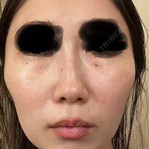 AB美容クリニックの口コミ