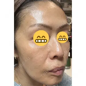 口コミ