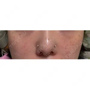 Natural Skin Clinic Natural Skin Clinic 自由ヶ丘院口コミ