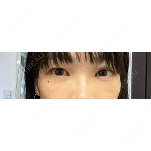東京BELLEZZAクリニック口コミ
