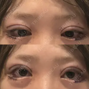 プロミス整形外科口コミ