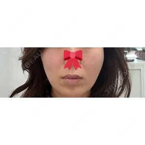 APスキンクリニック銀座の