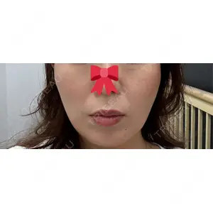 APスキンクリニック銀座の