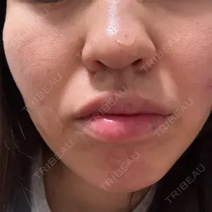 パーソナルビューティークリニック東京 【PBC TOKYO 銀座店】口コミ