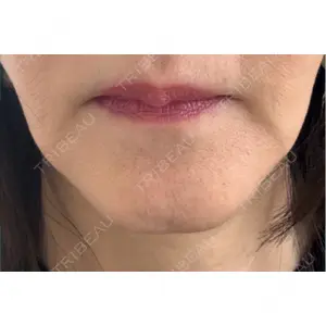 ノリス美容クリニック口コミ