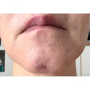 ノリス美容クリニック口コミ