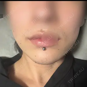 アリエル美容クリニック アリエル美容クリニック 横浜院口コミ