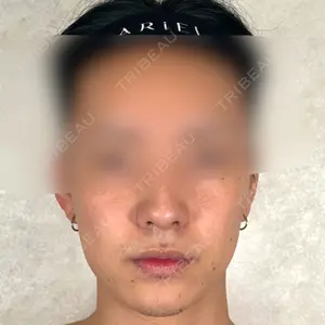 アリエル美容クリニック アリエル美容クリニック 横浜院口コミ