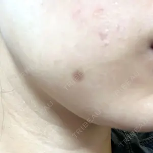 Fellez Clinic【フェルズクリニック】口コミ