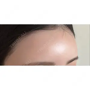 plume clinic plume clinic口コミ