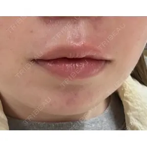 HAAB BEAUTY CLINIC 南青山本院（新院）口コミ