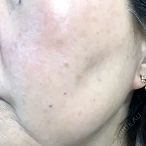 おおかみ美容のクリニック おおかみ美容のクリニック 新宿院口コミ