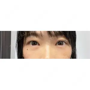 東京BELLEZZAクリニック口コミ