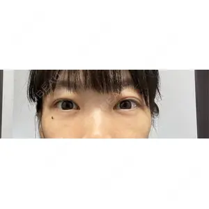 東京BELLEZZAクリニック口コミ