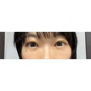 東京BELLEZZAクリニック口コミ