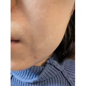 ゆきスキンクリニック 東池袋口コミ