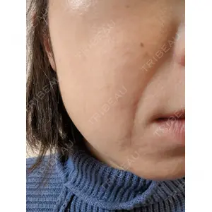 ゆきスキンクリニック 東池袋口コミ