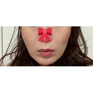 APスキンクリニック銀座の