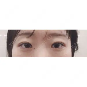 HAAB×DREAM BEAUTY CLINIC 大阪梅田院の