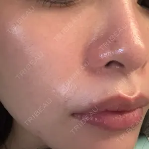 銀座TMクリニック口コミ