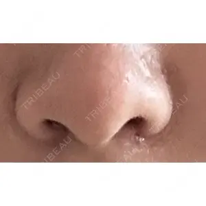 吉祥寺アイビークリニック口コミ