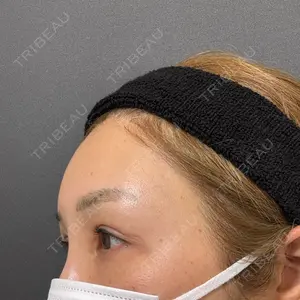 plume clinic plume clinic口コミ